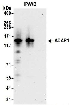 Rabbit ADAR1 Antibody