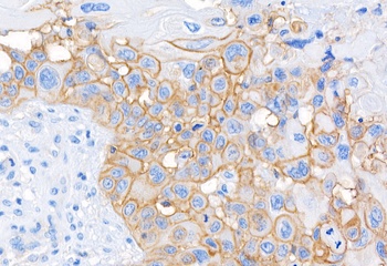 Rabbit CD44 Antibody