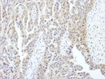 Rabbit PSMD1 Antibody