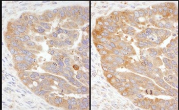 Rabbit RPS3 Antibody
