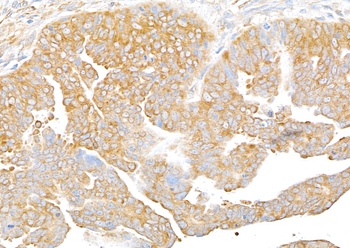 Rabbit RPS3 Antibody