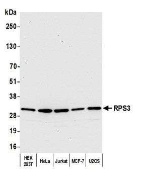 Rabbit RPS3 Antibody