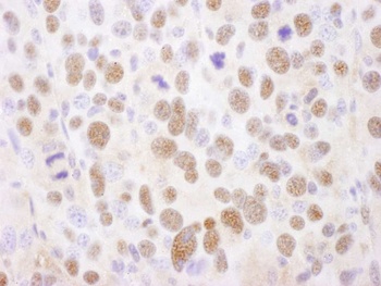 Rabbit PSMA2 Antibody