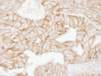 Rabbit Alpha-Adducin Antibody