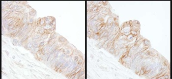 Rabbit Alpha-Adducin Antibody