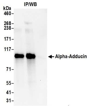 Rabbit Alpha-Adducin Antibody