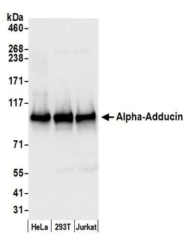 Rabbit Alpha-Adducin Antibody