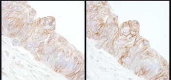 Rabbit Alpha-Adducin Antibody
