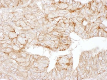 Rabbit Alpha-Adducin Antibody