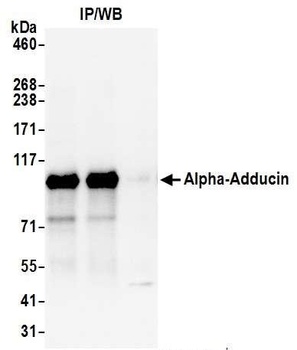 Rabbit Alpha-Adducin Antibody