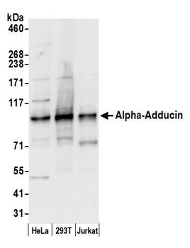 Rabbit Alpha-Adducin Antibody