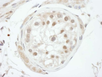 Rabbit GTF2H1 Antibody