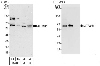 Rabbit GTF2H1 Antibody