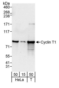 Rabbit Cyclin T1 Antibody