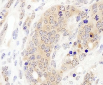 Rabbit CCT3 Antibody