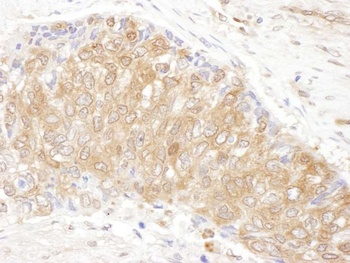 Rabbit CCT3 Antibody