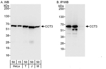 Rabbit CCT3 Antibody