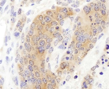 Rabbit CCT3 Antibody
