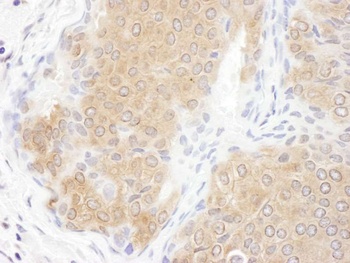 Rabbit CCT3 Antibody
