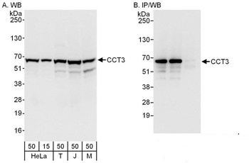 Rabbit CCT3 Antibody