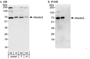 Rabbit Atlastin2 Antibody