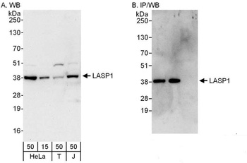 Rabbit LASP1 Antibody