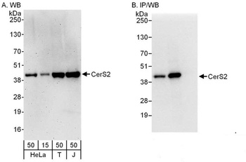 Rabbit CerS2 Antibody