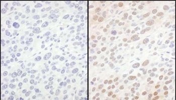 Rabbit eIF6 Antibody