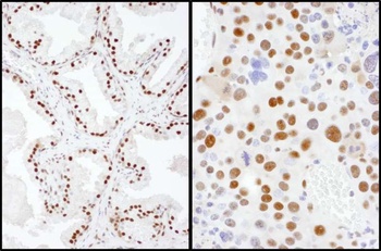 Rabbit SAE2 Antibody