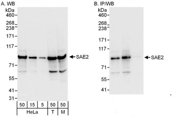 Rabbit SAE2 Antibody
