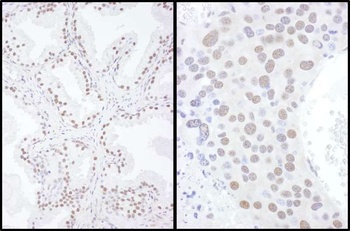 Rabbit SAE2 Antibody
