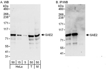 Rabbit SAE2 Antibody