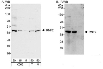 Rabbit RNF2 Antibody
