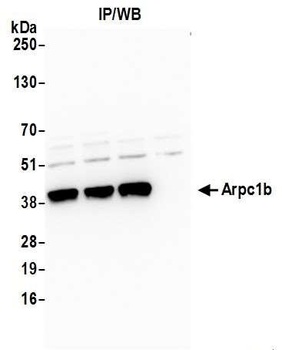 Rabbit Arpc1b Antibody