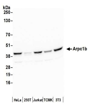 Rabbit Arpc1b Antibody