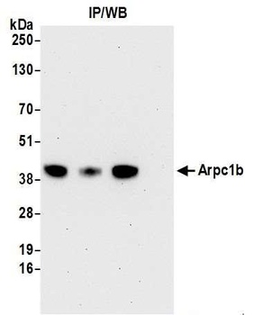 Rabbit Arpc1b Antibody