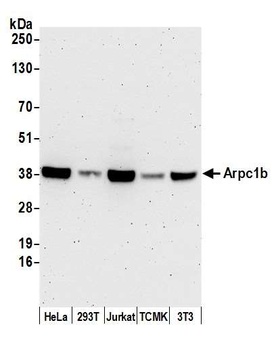 Rabbit Arpc1b Antibody