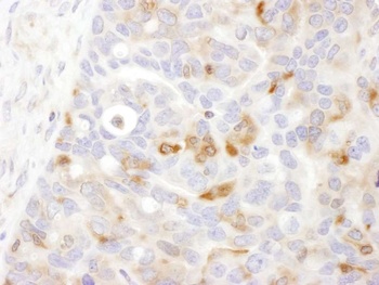 Rabbit Bin1 Antibody