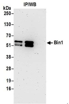 Rabbit Bin1 Antibody