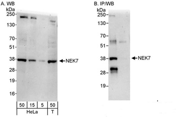 Rabbit NEK7 Antibody