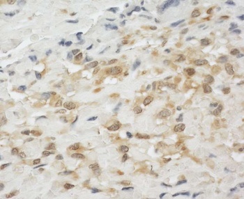 Rabbit LPP Antibody
