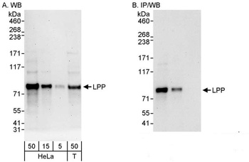Rabbit LPP Antibody