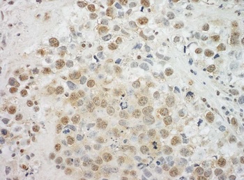Rabbit EYA4 Antibody