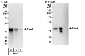 Rabbit EYA4 Antibody