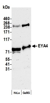 Rabbit EYA4 Antibody