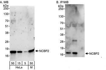Rabbit NCBP2 Antibody