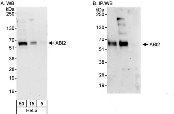 Rabbit ABI2 Antibody