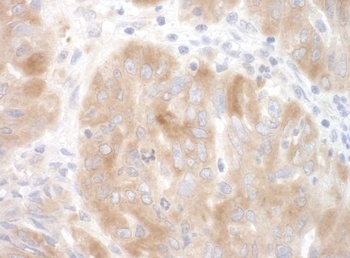Rabbit SRPK2 Antibody