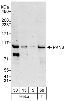 Rabbit PKN3 Antibody