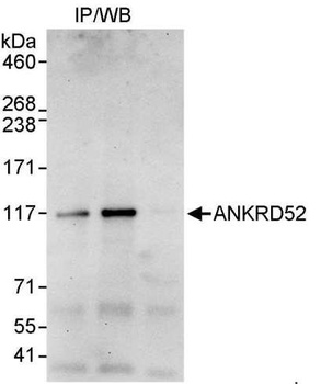 Rabbit ANKRD52 Antibody